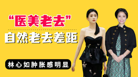 医美老去和自然老去差距?林心如肿胀明显,贾静雯完全就是逆生长